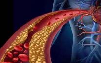 ѪҺ�е���������������ɶΣ����